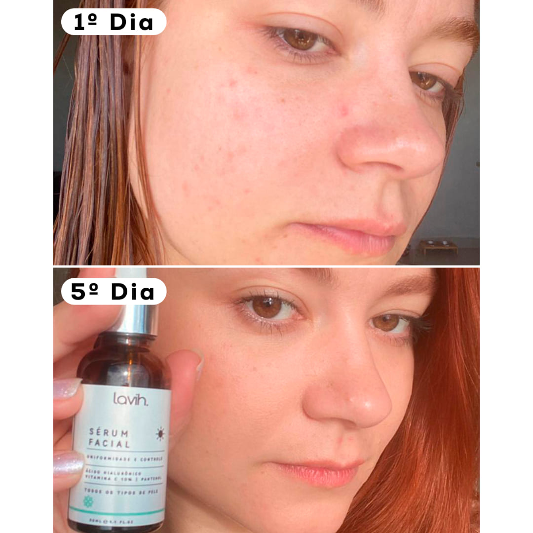 Kit Para Pele Seca/Sensível Lavih Cosmetics